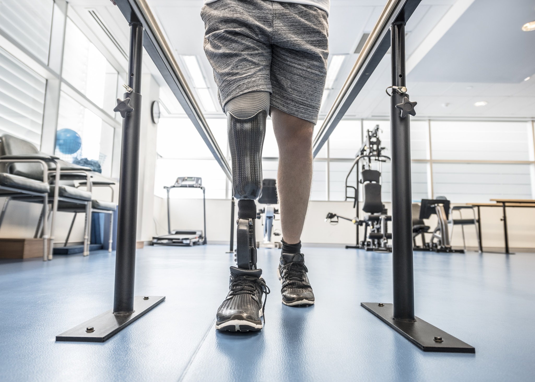 Prosthetic Leg - Below-Knee Prosthetics - Prosthetic Orthotic
